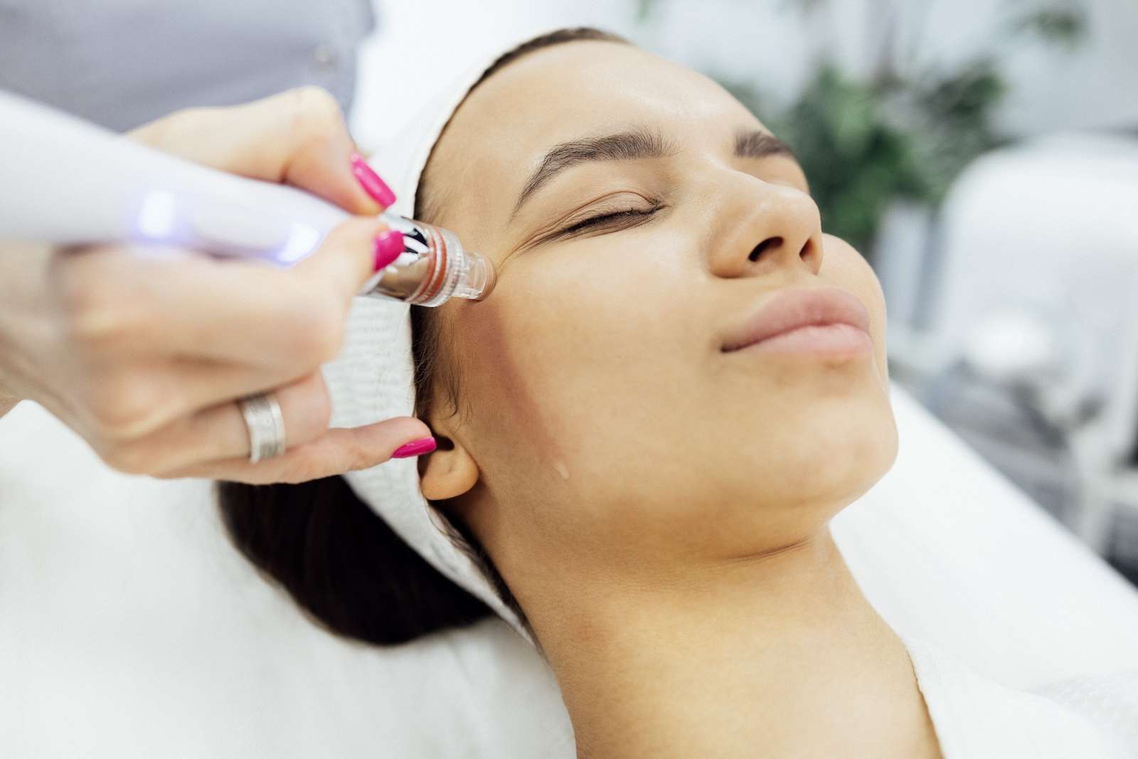 woman undergoing microdermabrsion session for skin hydration to congested skin
